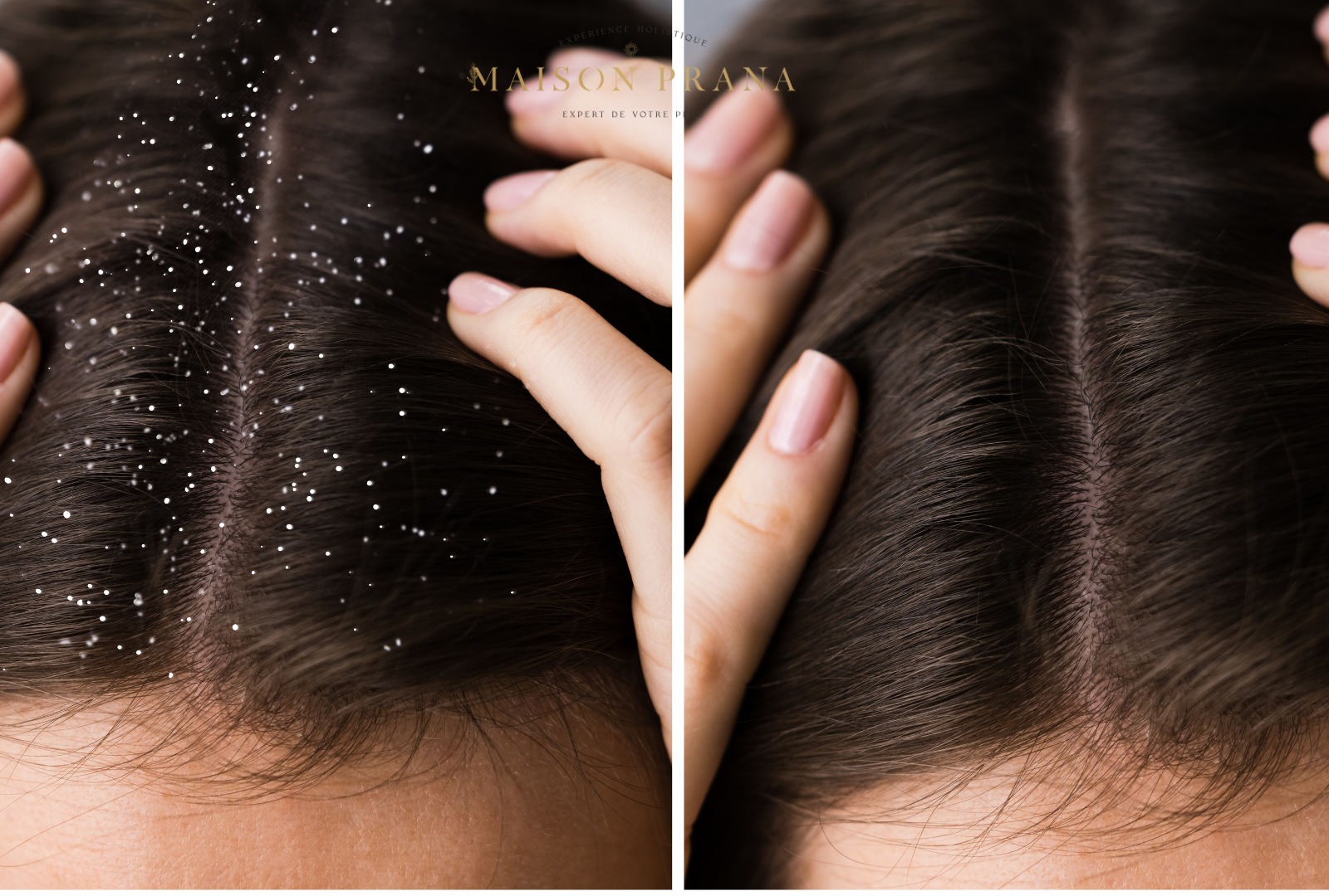 soin perte cheveux avignon