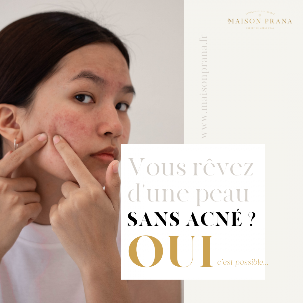 Comment ne plus avoir d'acné : bilan vitalité et soin visage découverte avec 150 euros de produits offerts pour achat de cure