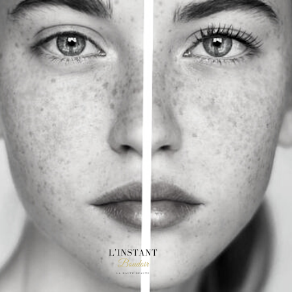 lashes botox avignon dans le vaucluse