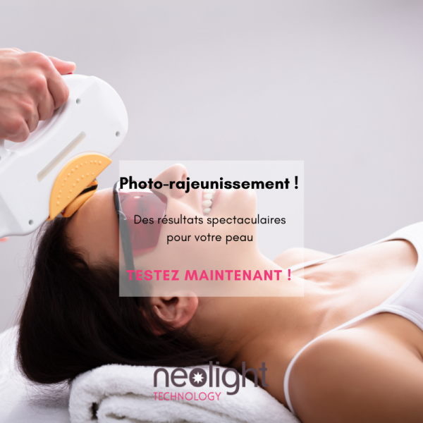 Photorajeunissement avignon