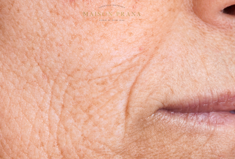 soin anti age naturelle avignon vaucluse