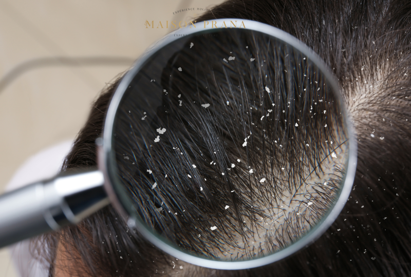 Diagnostic cuir chevelu avignon