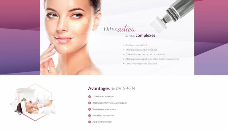 Microneedling avignon le pontet