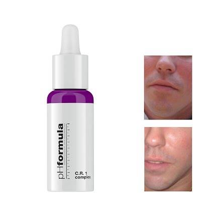 Peeling peau sensible proche avignon