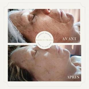 Notre zone d'activité pour ce service Soins du cuir chevelu Head Spa