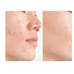 Nos prestations sur le secteur de Le Pontet