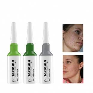 Notre zone d'activité pour ce service Salon de beauté pour traitement de l'acné hormonale